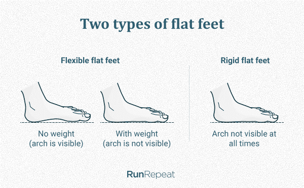 2 types of flat feet
